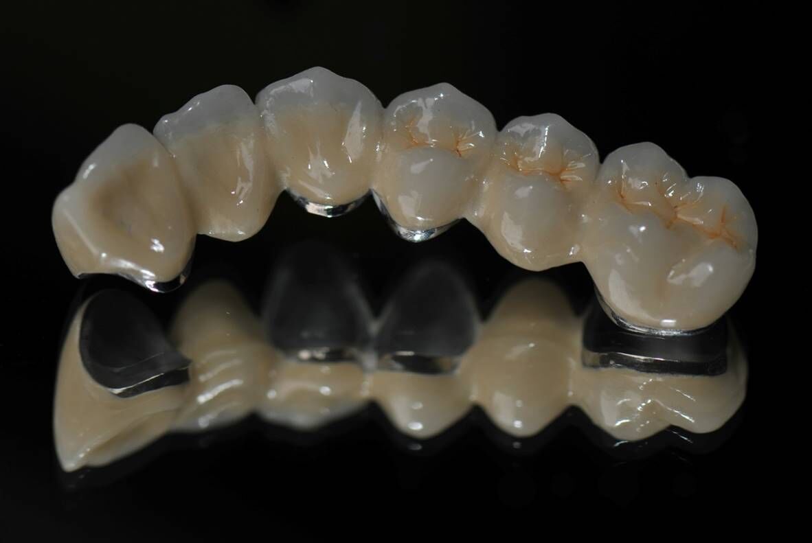 3D打印时代，定制牙齿不再是梦