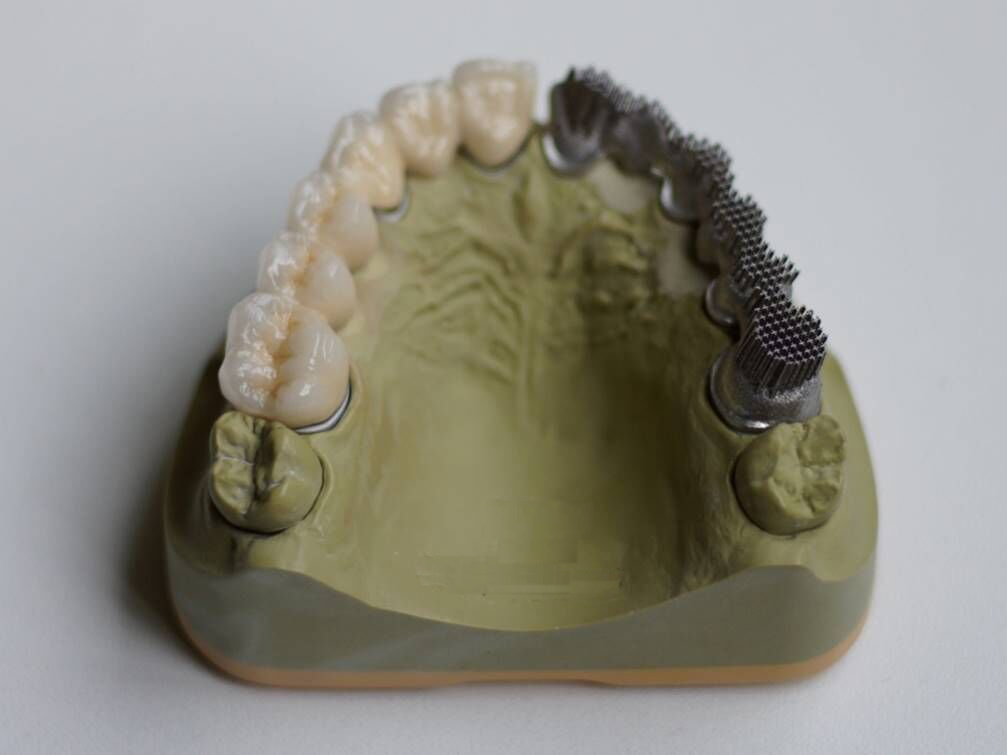 3D打印时代，定制牙齿不再是梦