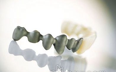 德国激光纳米生物瓷牙
