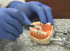 治疗龋洞新方法——无需钻牙和充填